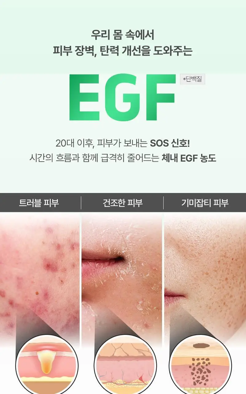[장벽탄력/트러블] 지피덤 셀트리온EGF 스킨베리어 인텐시브 크림 80ml 기획 (+크림15ml+앰플1ml*3ea) 상세페이지 15